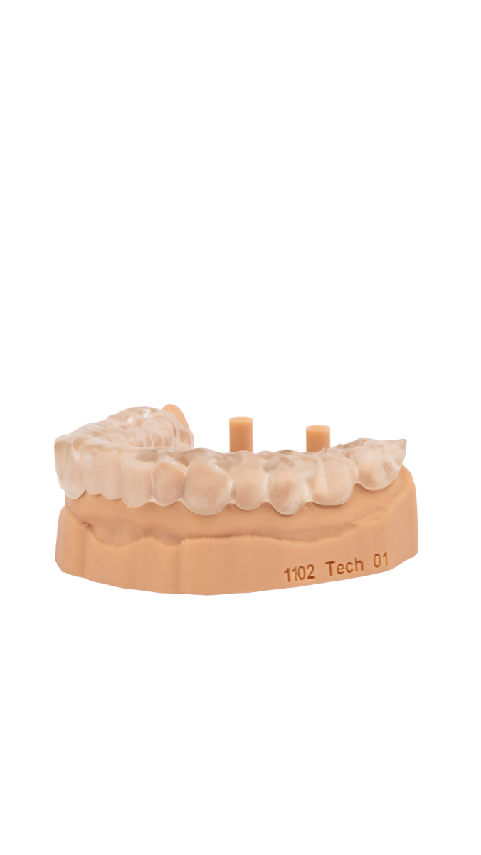 Aligner Resin