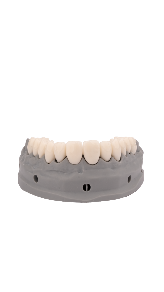 Composite Resin