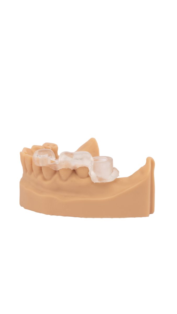 Guide Resin