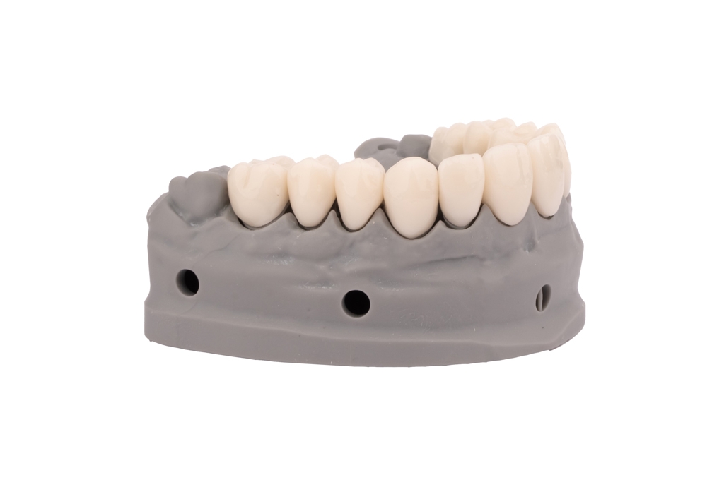Outperforming the Standards: CRS Composite Resin vs. Competitor Resins