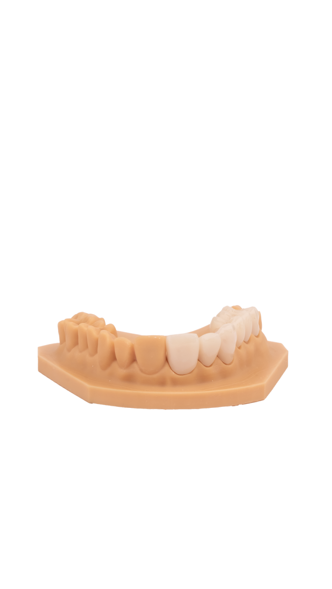Trial Resin